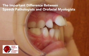 The Important Difference Between Speech Pathologists and Orofacial Myologists